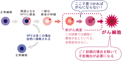 がん細胞